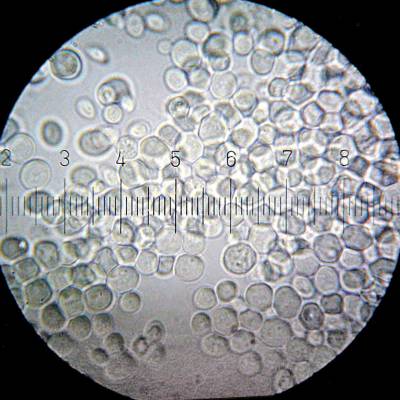 Hefezellen unterm Mikroskop